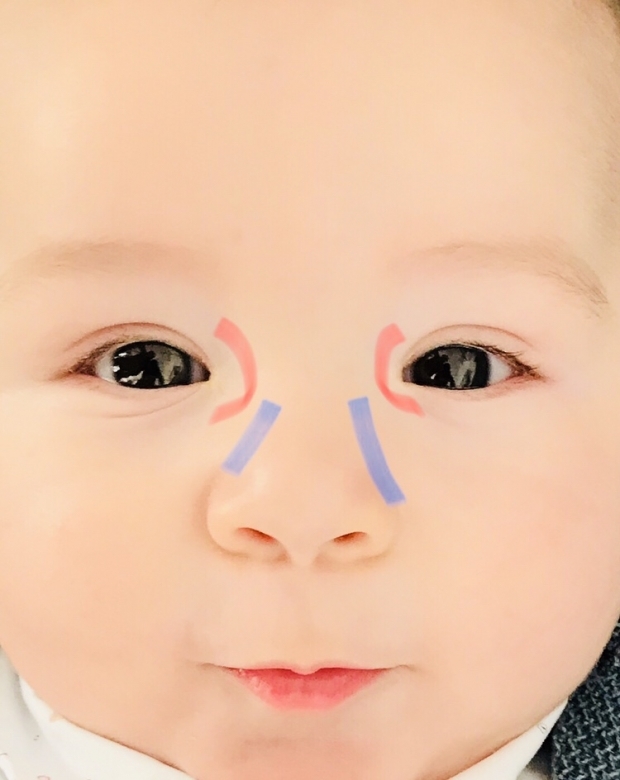 Масаж на окото при бебета