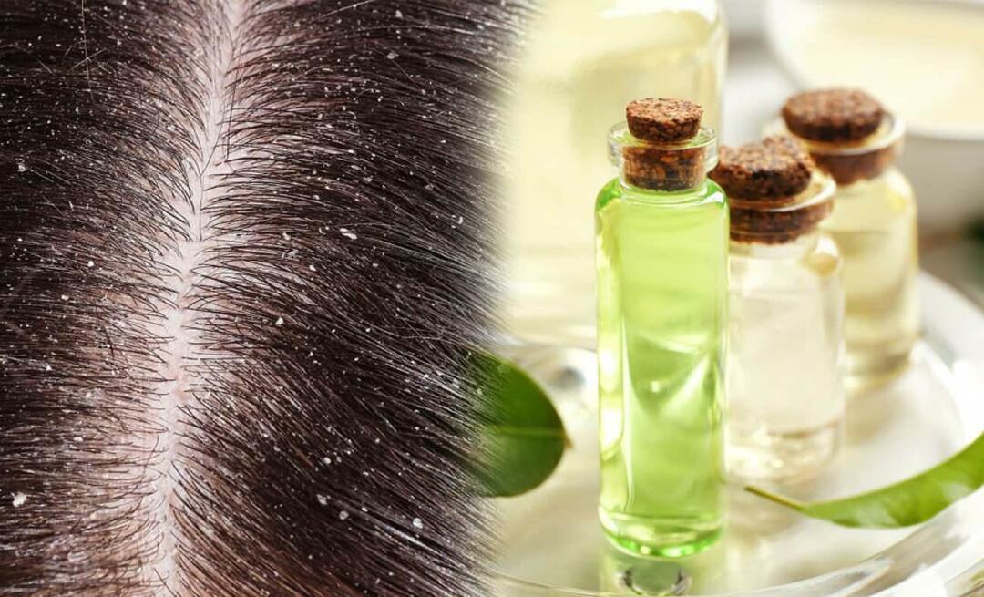 Можете ли да използвате масло от чаено дърво за пърхот? Можете ли да нанесете масло от чаено дърво върху косата си и добре ли е?