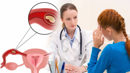 Какво е извънматочна бременност (извънматочна бременност), защо? Какви са признаците на извънматочна бременност?