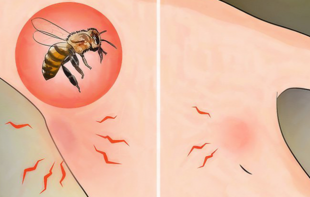 Какво представлява алергията към пчелите и какви са симптомите? Естествени методи, които са полезни за пчелните ужилвания