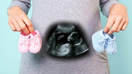 Ще се определи ли полът на бебето през първия триместър на бременността?