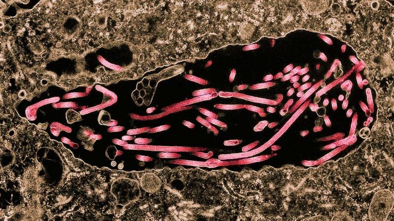изображение на еболан, разпространяващ се в клетките