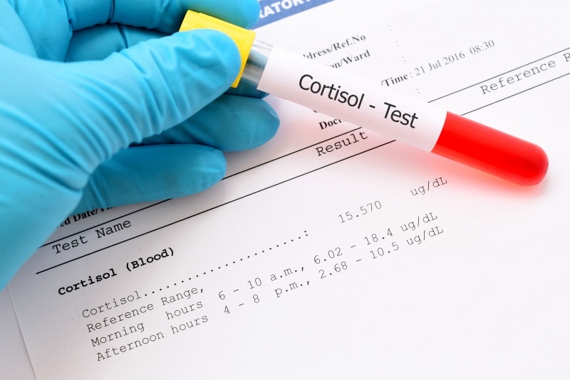 нивото на кортизол се среща при кръвни тестове