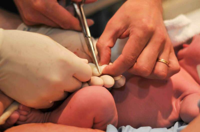 Кога трябва да се прерязва пъпната връв при бебетата?
