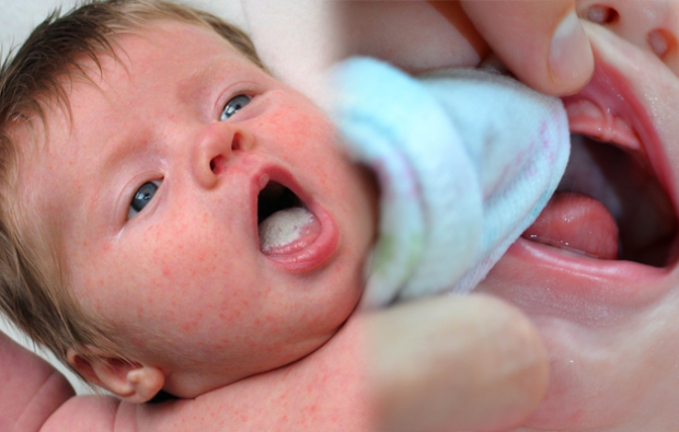 Как са раните в устата при бебета