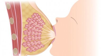 Какво е мастит (възпаление на гърдата)? Симптоми на мастит и лечение по време на кърмене