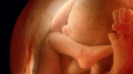 Не показва пол на бебето на ултразвук! Как изглеждат бебетата момчета и момичета на ултразвук?