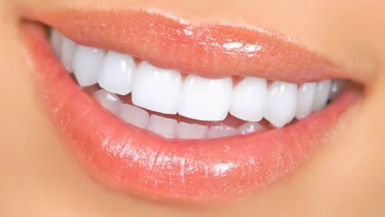 Естествени методи за избелване на зъбите