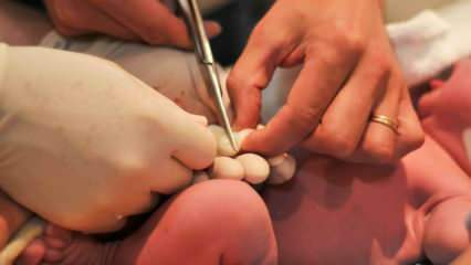 Кога се прерязва пъпната връв при бебетата? Предимства на късото рязане на пъпната връв