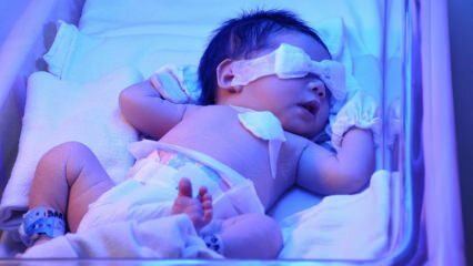 Какво е жълтеница за новородено? Как преминава жълтеницата при бебетата у дома? Степен на жълтеница при кърмачета