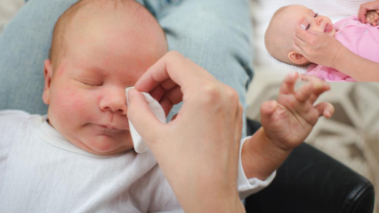 Как да премахнете рани при бебета? Причинява изригване на очите при бебета? Масаж на бур с кърма