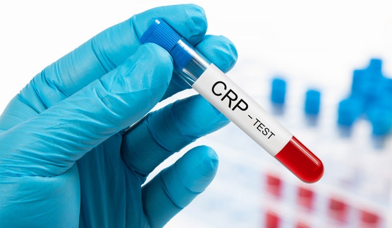 Защо CRP в кръвта се повишава? Какво е CRP? Как да намалим CRP?