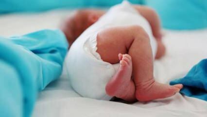 Трябва ли бебетата да имат ултразвук на тазобедрената става?