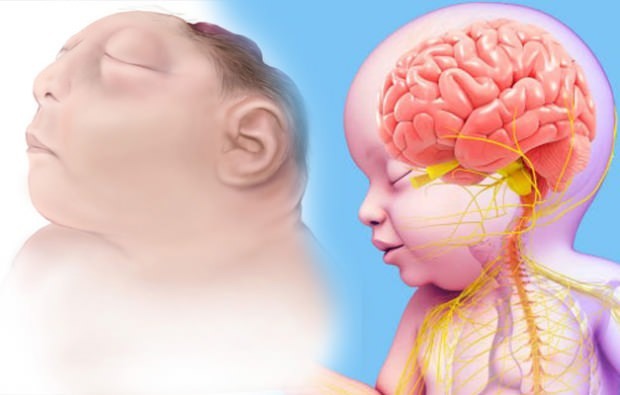 Живее ли бебето на Аненцефалия? Аненцефална диагноза