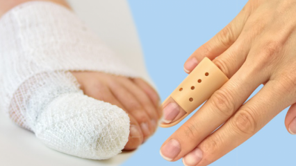 Какво причинява счупване на пръста? Какви са симптомите на счупване на пръста?