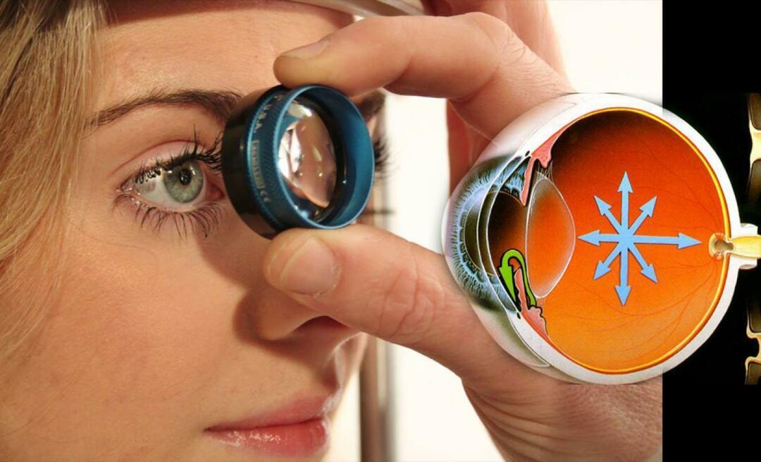 Какво представлява глаукомата? Обърнете внимание на това заболяване, което протича коварно, без да дава никакви симптоми!