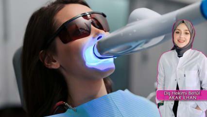 Как се извършва методът за избелване на зъбите (Bleaching)? Методът на избелване уврежда ли зъбите?