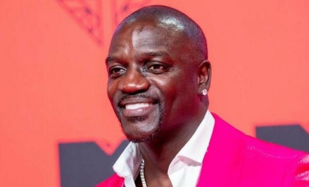 Американската певица Akon също предпочете Турция за присаждане на коса! Ето цената, която плати...
