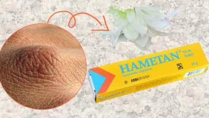 Какво прави Хаметан крем? Хаметан крем за домашна употреба! Хаметан разлики