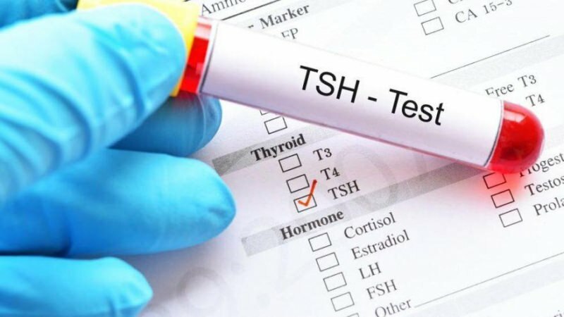 tsh тестът е хормонален тест