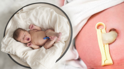 Какво е Placenta Previa? Как да се грижим за пъпната връв при бебета? Ако пъпната връв е дълга ...