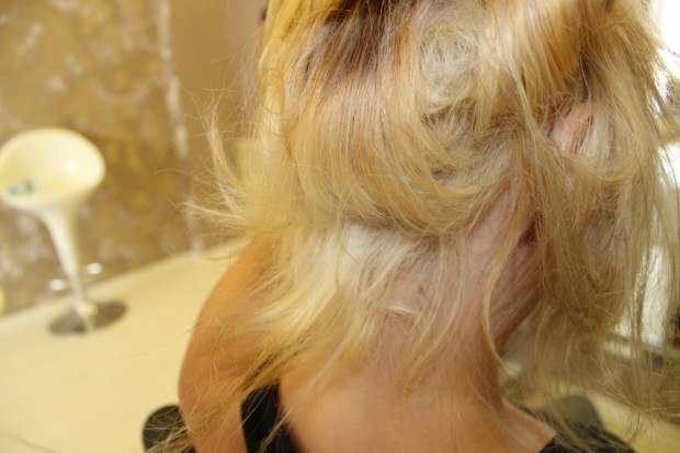 Какво се прави с горящата коса от средата? Как трябва да се поддържа третираната коса?