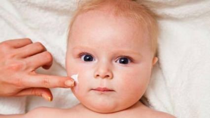 Съвети за грижа за кожата за бебета! Какви са кожните проблеми при бебетата?