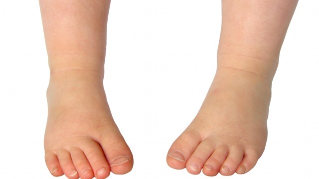 3-те най-често срещани проблеми в здравето на краката