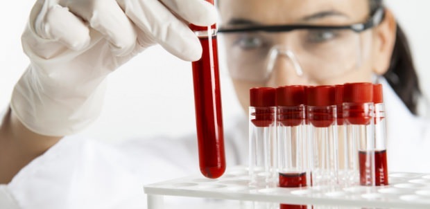 нивото на хемоглабина се проверява чрез кръвен тест