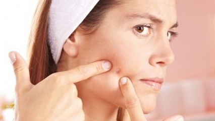 Естествени препоръки за грижа за кожата на пъпки