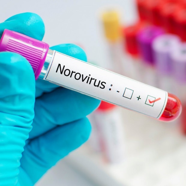 Какво е норовирус и какви заболявания причинява