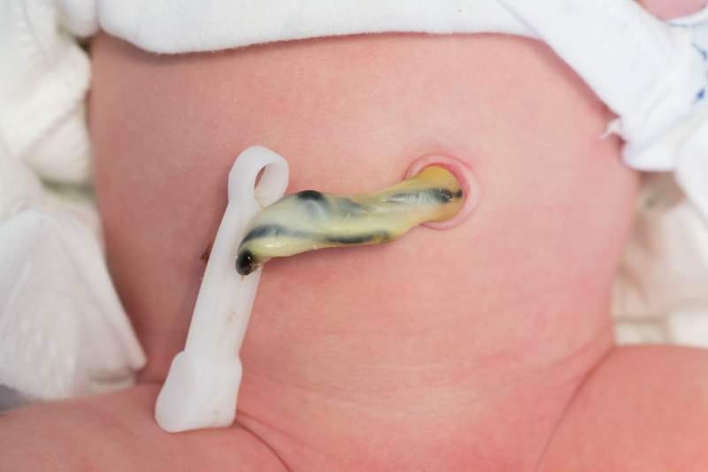 Кога пъпната връв отпада при бебетата?