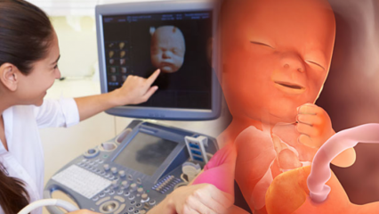 Кой орган се развива първо при кърмачета? Развитие на бебето седмица по седмица