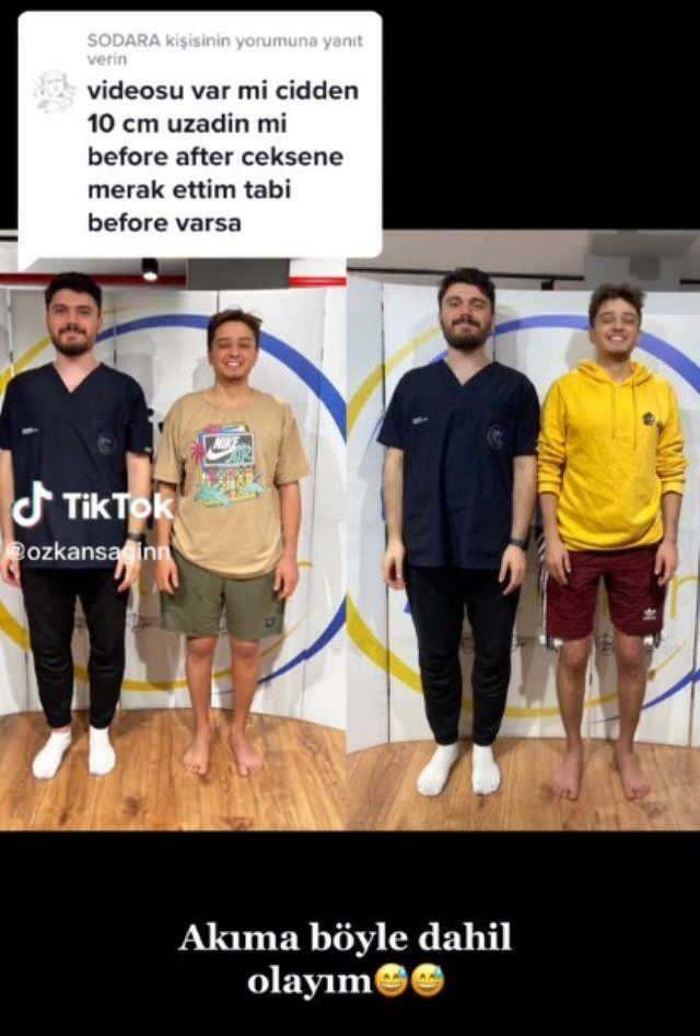 Özkan Sağın направи преди и след операцията