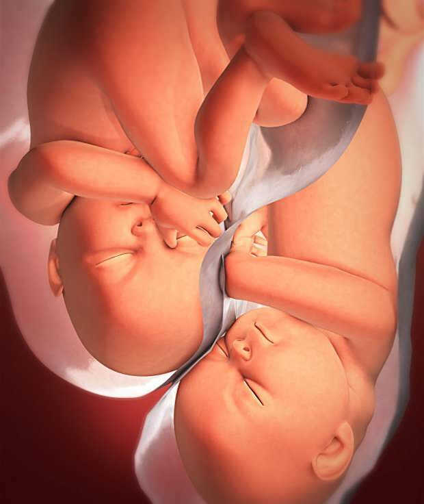Какви са симптомите на бременността близнаци?