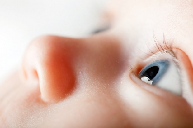 Какво причинява появата на пукнатини при бебетата?