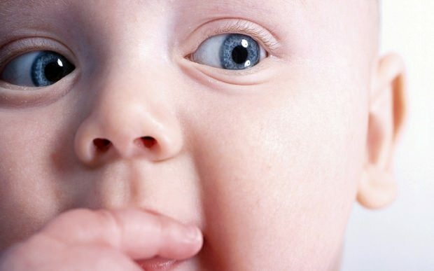 Защо изместване на очите при бебетата?