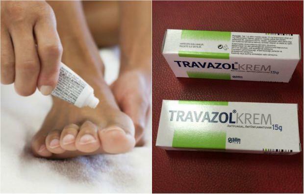 Какво прави кремът travazol? Как се използва крем травмол? Цена на крем Travazol
