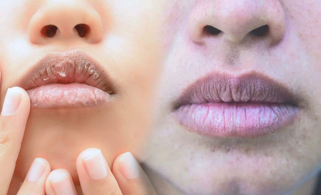 Какво причинява тъмните устни? Как се лекуват потъмняването или натъртването на устните?