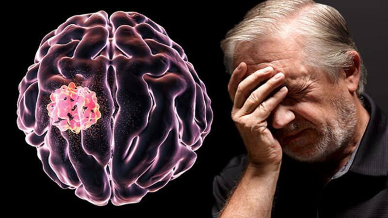 Тъканта, образувана в мозъка от нарушаване на клетъчните структури, се нарича тумор.