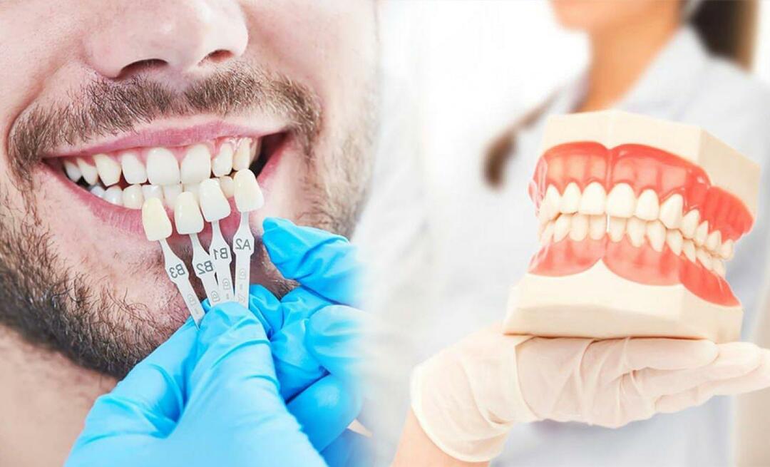 Защо се поставя циркониева фасета върху зъбите? Колко издръжливо е циркониевото покритие?