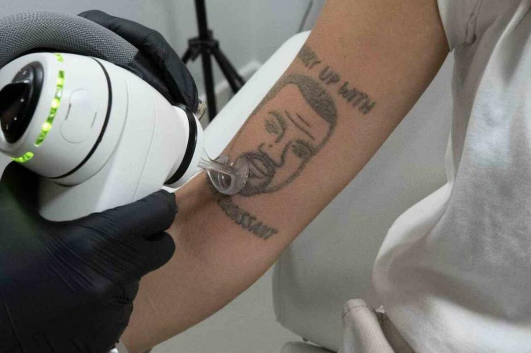 Татуировката на Кание Уест ще бъде премахната безплатно в Лондон 