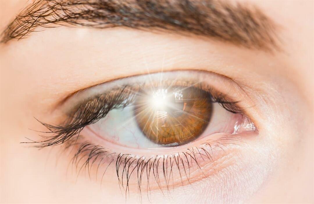 Какво причинява светкавици в окото и как се лекува?