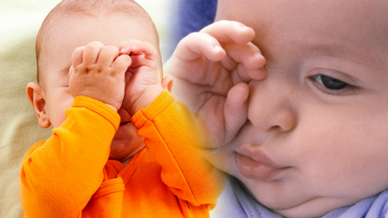 Естествени решения за изгаряне на очите при бебета
