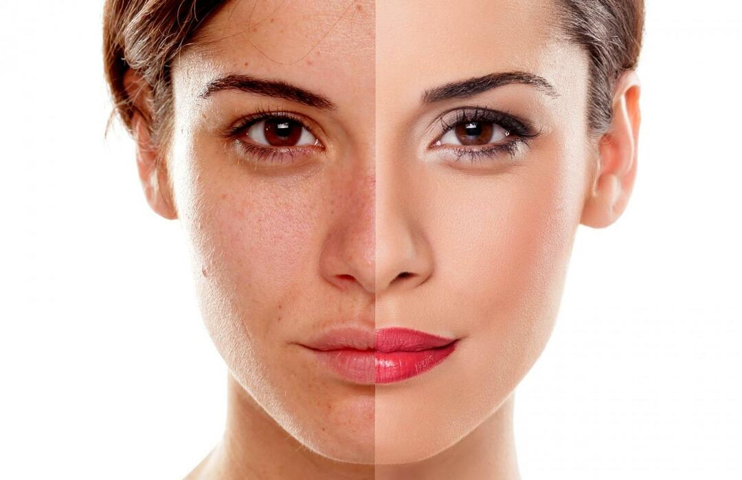 Как да предотвратим кожата да изглежда уморена? Как да намалим уморения вид на кожата?