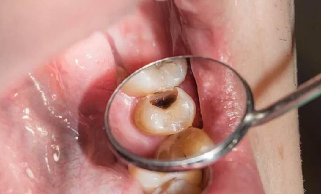 Защо зъбите гният и какво можем да направим, за да го предотвратим? 