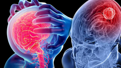 Какво представлява дегенерация на церебелум (гръбначен мозък)? Какви са симптомите на малкия мозък (гръбначния мозък)?