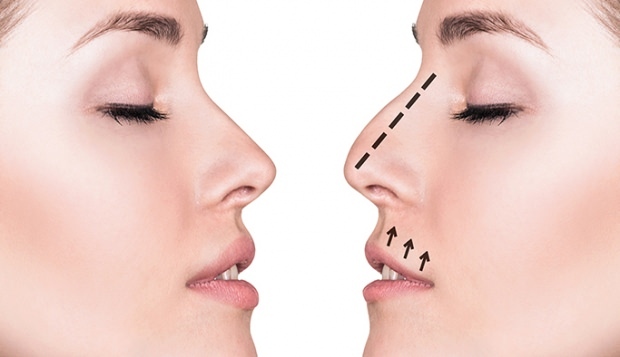 Неща, които трябва да се имат предвид в естетиката на носа