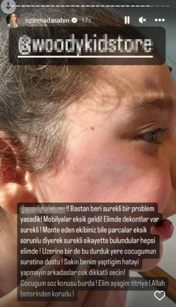 Вратата на гардероба падна върху лицето на дъщерята на Berkay Şahin