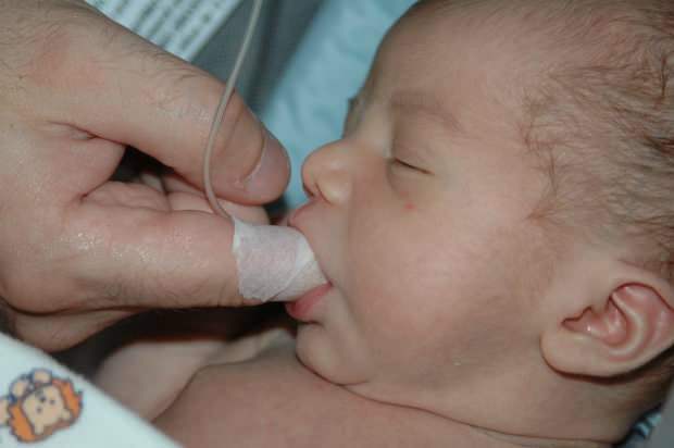 Какъв е методът на хранене с пръсти? Как да храним бебето със спринцовка?